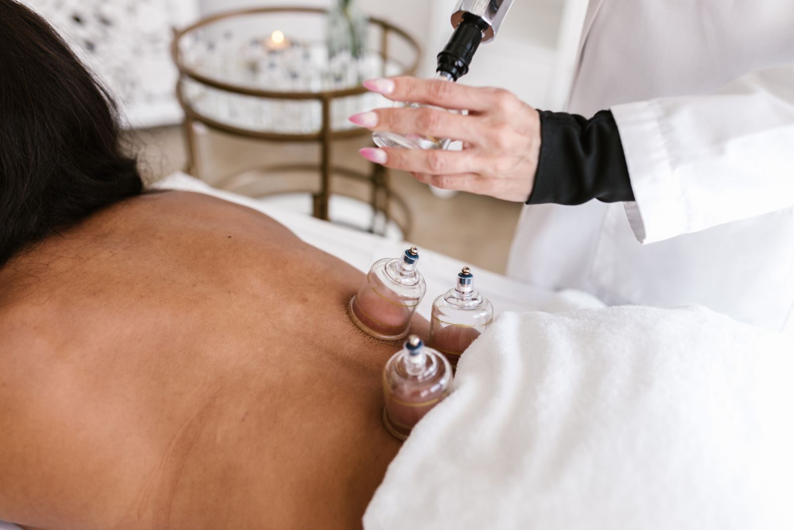 Glass cups placed on a person's upper back during a cupping session